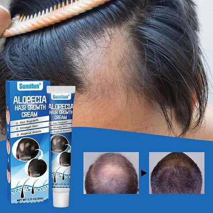 Sumifun Original Hair Growth Cream | Anti Hair Loss & Natural Hair Regrowth Solution